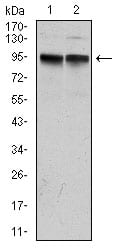 KCNQ1