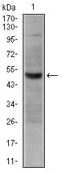 CD30