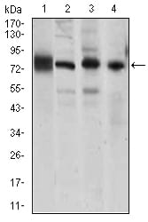 CDH5