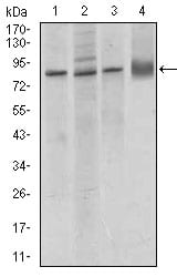 CDH5