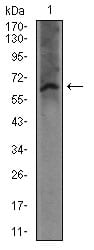 FCER1A