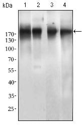 EGFR mutant
