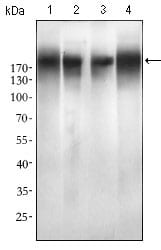 EGFR mutant