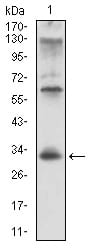 CD74