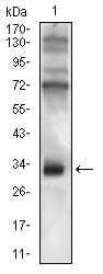 CD74