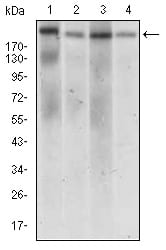 DNMT1