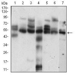 CCNE1