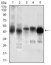 PDK2