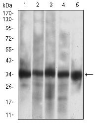 CASP-7
