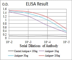 EIF5A