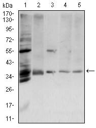 ANXA5