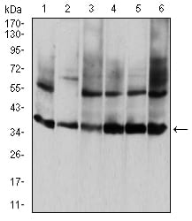 ANXA5