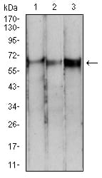 PDPK1