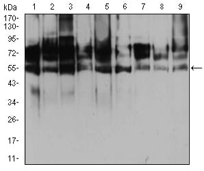 HDAC2