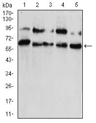 CBX2