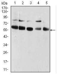 CBX2