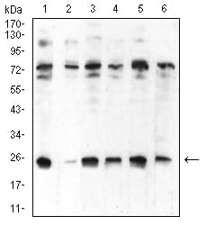 CBX5