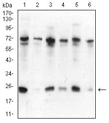 CBX5