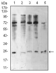 CBX5