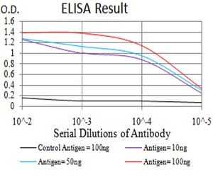 HDAC6