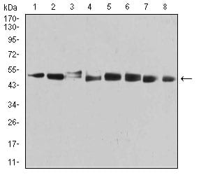 PSMC3