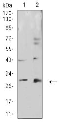 CALB2