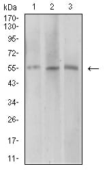 AEBP2