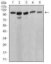 ATP2A1