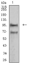 NCAM1