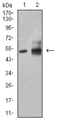 ALDH1A1