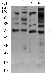 CHRNA7