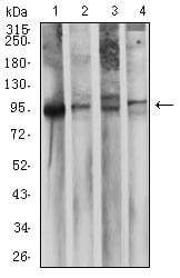 CD10