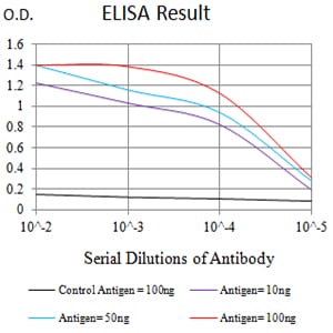 CD158E1