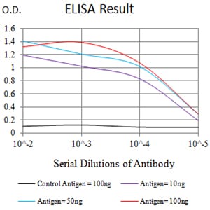 CD158E1