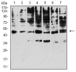 KIR3DL1