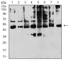 KIR3DL1