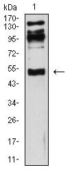 CD119