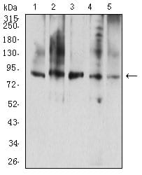 CD114