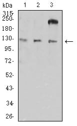 CD11a