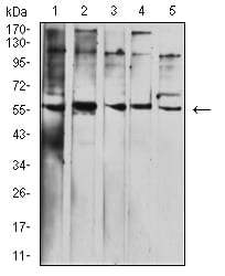 BTN1A1