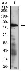 CD49D