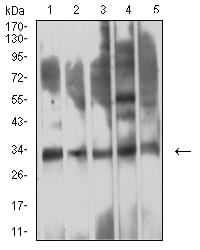 CD354