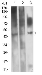 CD361