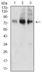ACSS1