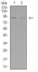 NCAM1