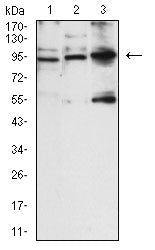 NCAM1