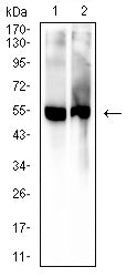 5-hydroxyuridine