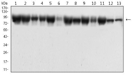 CTNNB1