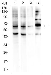 GPC3