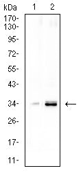 CCND1